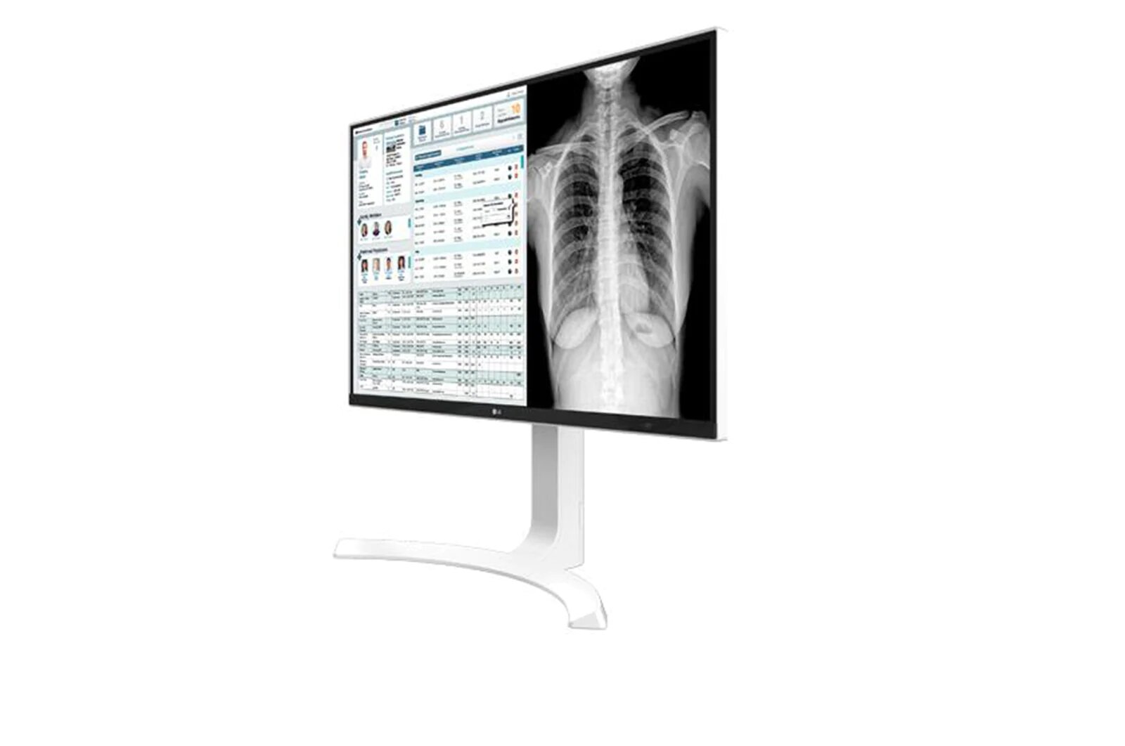 Monitor Clínico 27" 8MP