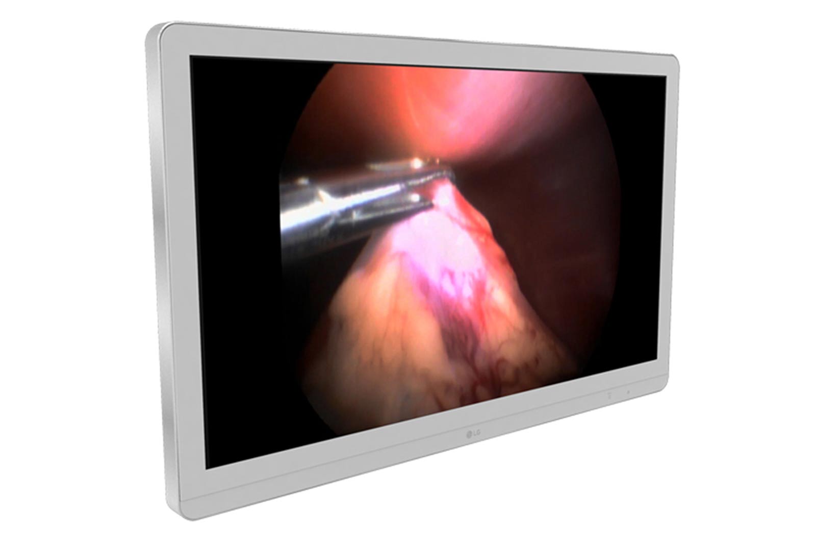 Monitor Quirúrgico 27"