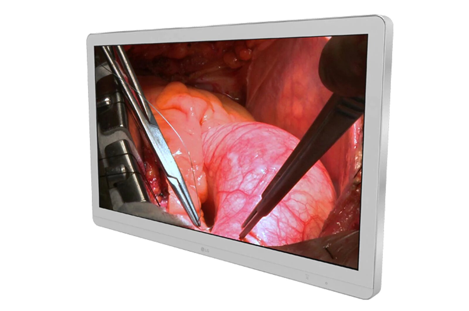 Monitor Quirúrgico 27"