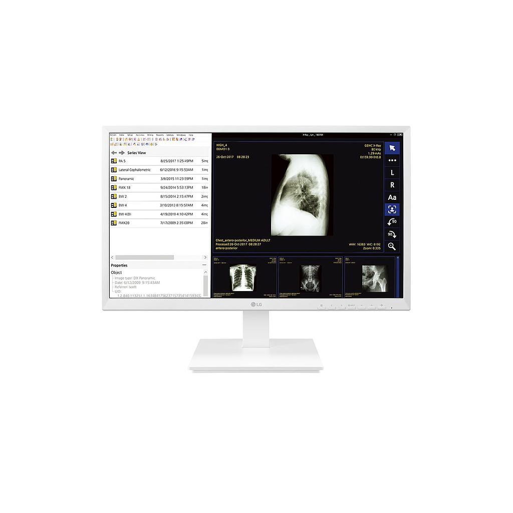 24CK550N-3A 24” All-in-One FHD IPS Thin Client